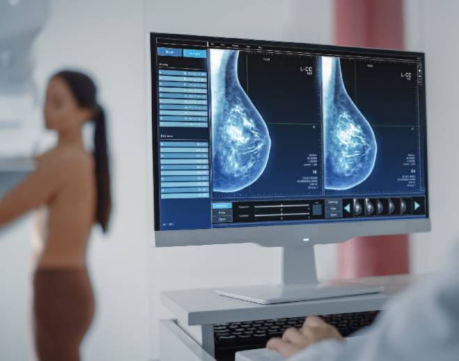 Mamografía para detección del cáncer de mama